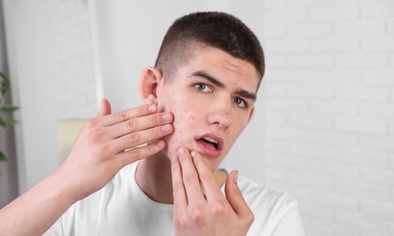 man looking at acne in a mirror after taking a pre workout supplement